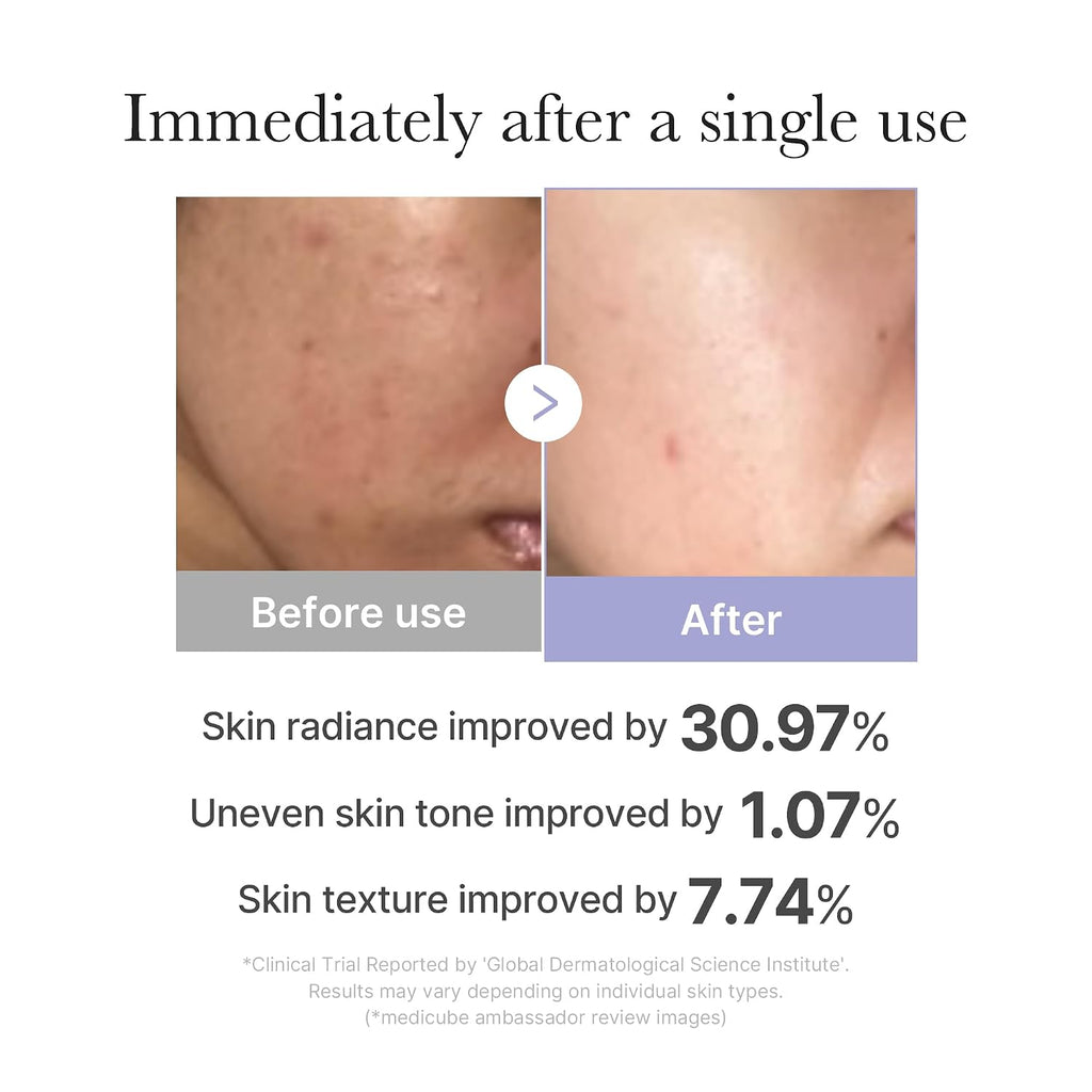 medicube Mini Booster Pro White | Affordable At-Home Facial Device for Beginners - Portable Glow Booster for Glass Skin, Boosting Skin Care Absorption, Skincare for Teens, Korean Skin Care