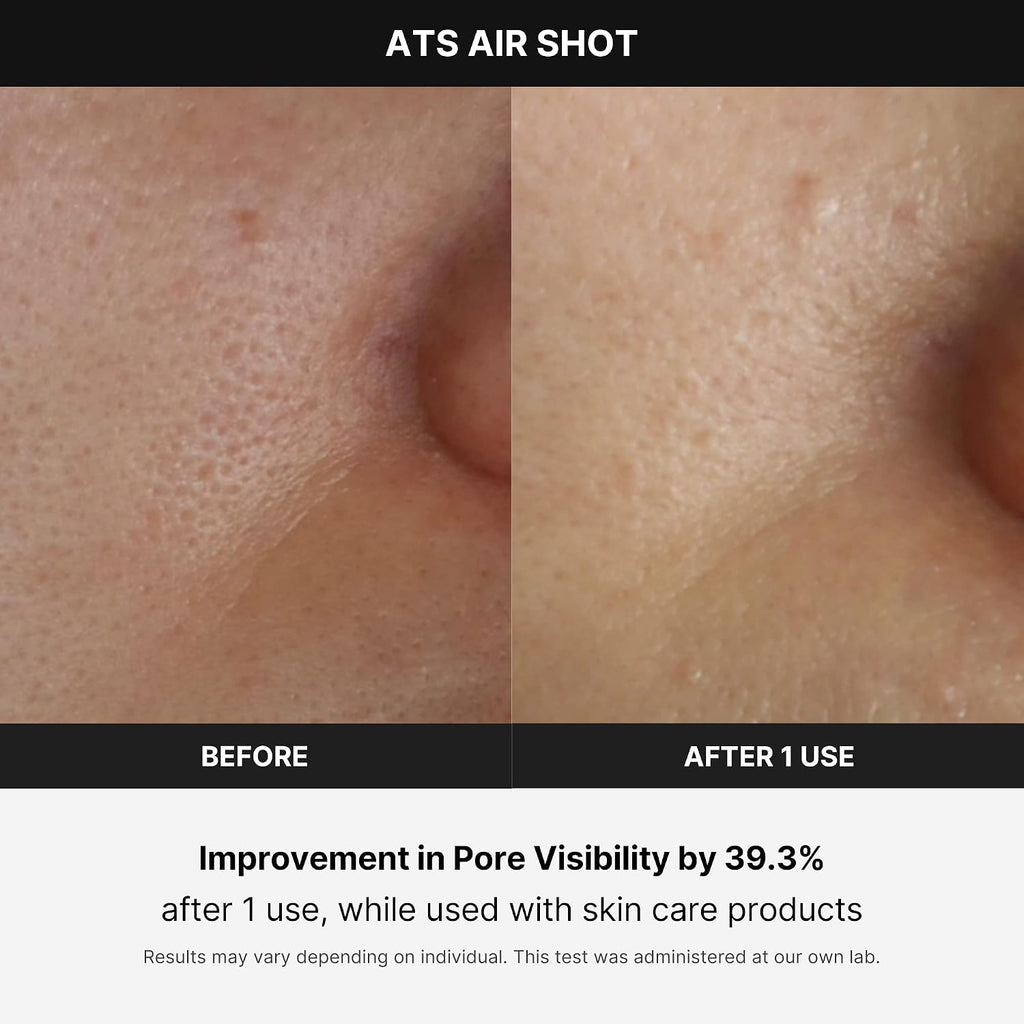Medicube Age-R ATS Air Shot - Microneedling Pore Tightening Skin Care Device for Enhanced Absorption, Pore Refinement, and Smoother Skin Texture - Exfoliation, Skin Rejuvenation - Korean Skin Care
