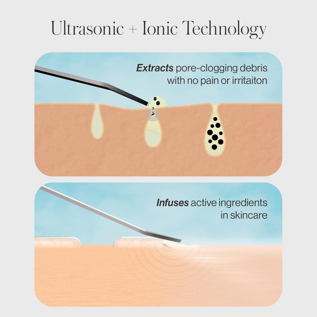 DERMAFLASH DERMAPORE+ Skin Care Device, Ultrasonic 2-in-1 Pore Extractor and Skincare Infuser, Stone