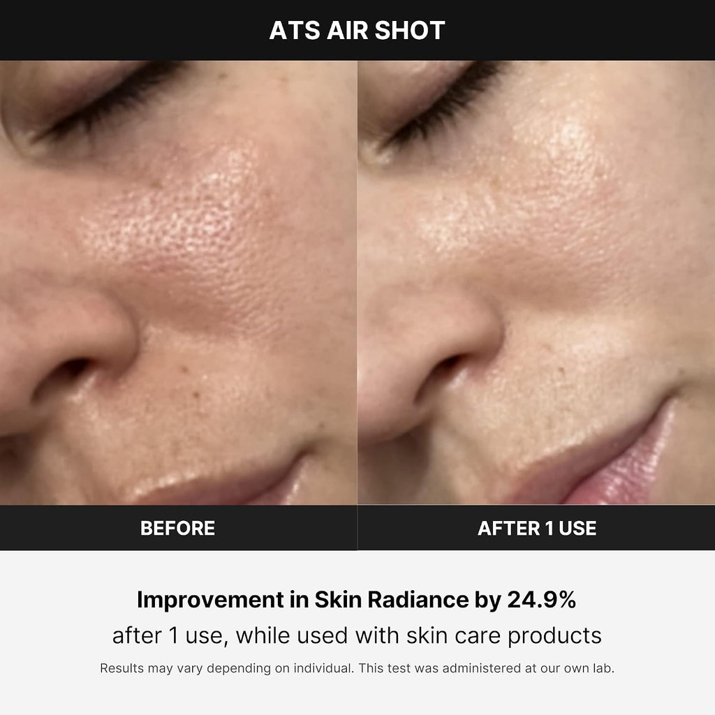 Medicube Age-R ATS Air Shot - Microneedling Pore Tightening Skin Care Device for Enhanced Absorption, Pore Refinement, and Smoother Skin Texture - Exfoliation, Skin Rejuvenation - Korean Skin Care