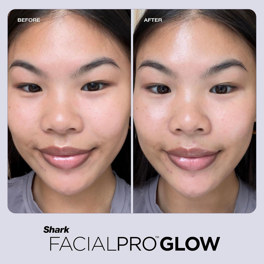 Shark FacialPro Glow at-Home Hydro-Powered Facial System with DePuffi Hot & Cold Therapy – Professional Spa Skincare Device for Pore Cleansing, Hydration, & Radiant Glow, Lilac, FH320PL